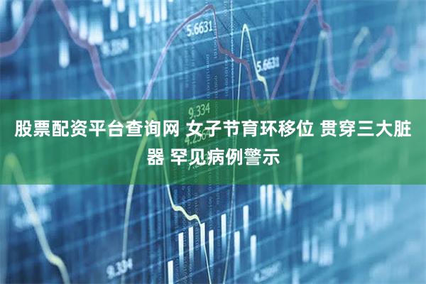 股票配资平台查询网 女子节育环移位 贯穿三大脏器 罕见病例警示